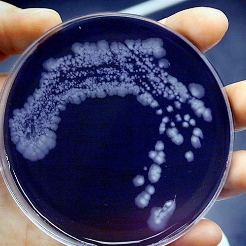 Afbeelding van Legionella-uitbraak in België eist eerste dode